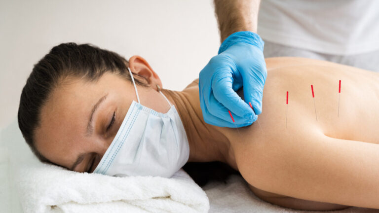 Best Dry Needling Therapist in Gurgaon